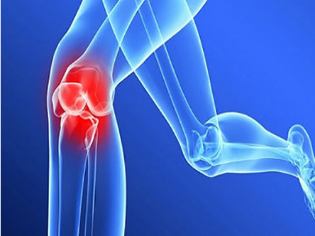 骨关节炎的病因_导致骨性关节炎的常见原因有哪些？